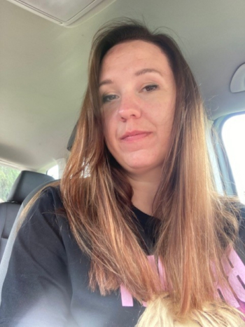 Mum of three too traumatised by rosacea to do the school run
