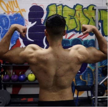 Personal trainer finally finds salvation for his psoriasis with a serum made with plant roots