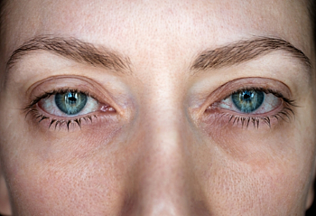 6 tips to avoid sore hay fever eyes 