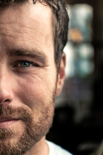 Reasons Why Men with Rosacea Should Wear Concealer